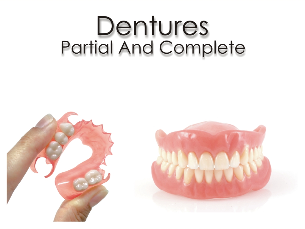 partial-complete-denture